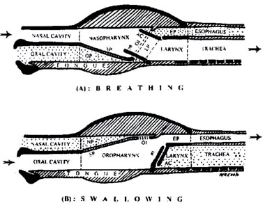 3-28e.jpg (41727 bytes)